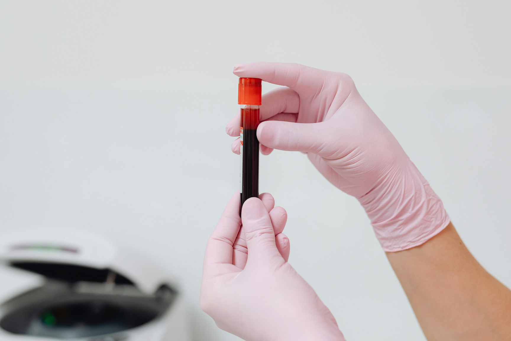 Науковці виявили генетичну залежність між результатами аналізу крові та психічними розладами